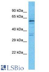 KRT76 / Keratin 76 antibody Western Blot of HeLa. Antibody dilution: 1 ug/ml.