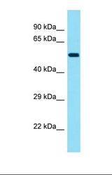 Western blot of Human HepG2. KRT78 antibody dilution 1.0 ug/ml.