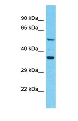 Western blot of KRT79 Antibody with human A549 Whole Cell lysate.