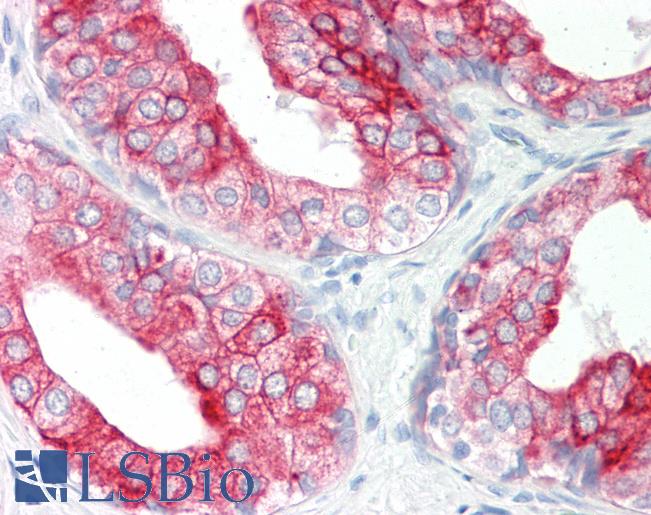 Human Prostate: Formalin-Fixed, Paraffin-Embedded (FFPE)