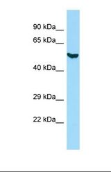 Western blot of Human HepG2 whole cell lysate. KRT8 antibody dilution 1.0 ug/ml.