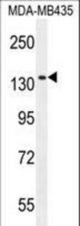 GRIN2A Antibody western blot of MDA-MB435 cell line lysates (35 ug/lane). The GRIN2A antibody detected the GRIN2A protein (arrow).