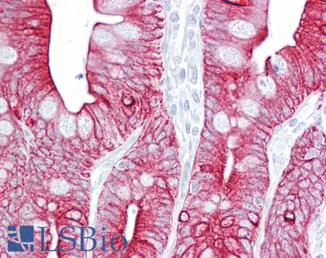 Anti-KRT8 / Cytokeratin 8 antibody IHC of human small intestine. Immunohistochemistry of formalin-fixed, paraffin-embedded tissue after heat-induced antigen retrieval. Antibody LS-B6824 concentration 5 ug/ml.