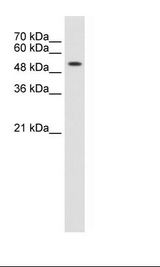 Jurkat Cell Lysate.