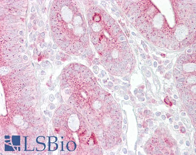 Anti-KRT8 / Cytokeratin 8 antibody IHC of human small intestine. Immunohistochemistry of formalin-fixed, paraffin-embedded tissue after heat-induced antigen retrieval. Antibody LS-B6825 concentration 5 ug/ml.