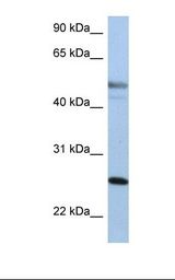 HepG2 cell lysate. Antibody concentration: 1.0 ug/ml. Gel concentration: 12%.