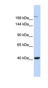 GRIN2A / NMDAR2A antibody LS-C109990 Western blot of Fetal Muscle lysate.