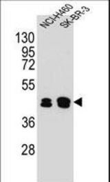 KRT80 Antibody western blot of NCI-H460,SK-BR-3 cell line lysates (35 ug/lane). The KRT80 antibody detected the KRT80 protein (arrow).