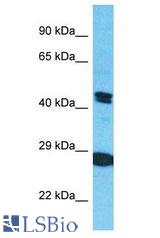 KRT80 antibody Western Blot of Jurkat. Antibody dilution: 1 ug/ml.