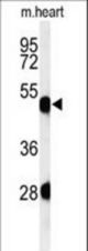 Western blot of KRT82 Antibody in mouse heart tissue lysates (35 ug/lane). KRT82 (arrow) was detected using the purified antibody.