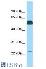 KRT85 antibody Western Blot of 721_B. Antibody dilution: 1 ug/ml.