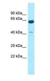 KRT9 / K9 antibody Western Blot of Fetal Heart.