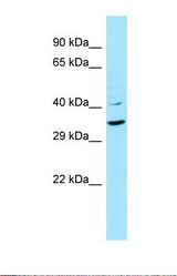 Western blot of Human COLO205. KRT9 antibody dilution 1.0 ug/ml.