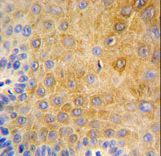 Formalin-fixed and paraffin-embedded human skin reacted with KRT9 Antibody (Center K444), which was peroxidase-conjugated to the secondary antibody, followed by DAB staining. This data demonstrates the use of this antibody for immunohistochemistry; clinical relevance has not been evaluated.