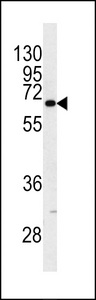 Western blot of KRT9 antibody (Center K444) in NCI-H460 cell line lysates (35 ug/lane). KRT9 (arrow) was detected using the purified antibody.