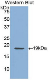 Western blot of recombinant KRT9 / K9.