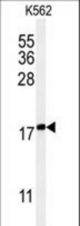 Western blot of KRTAP1-1 Antibody in K562 cell line lysates (35 ug/lane). KRTAP1-1 (arrow) was detected using the purified antibody.