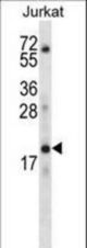 KRTAP13-3 Antibody western blot of Jurkat cell line lysates (35 ug/lane). The KRTAP13-3 antibody detected the KRTAP13-3 protein (arrow).