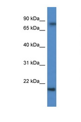 KRTAP1-5 antibody LS-C135833 Western blot of Fetal Brain lysate. Antibody concentration 1 ug/ml.