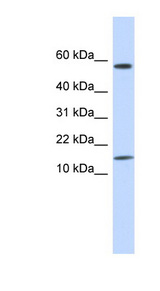 KRTAP11-1 antibody LS-C102199 Western blot of Placenta lysate.