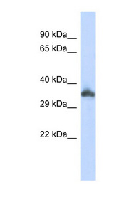 KRTAP24-1 antibody LS-C102200 Western blot of 293T cell lysate.