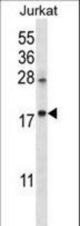 KRTAP25-1 Antibody western blot of Jurkat cell line lysates (35 ug/lane). The KRTAP25-1 antibody detected the KRTAP25-1 protein (arrow).