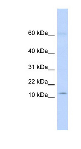 KRTAP8-1 antibody LS-C111074 Western blot of Fetal Heart lysate.