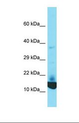 Western blot of Human Jurkat. KRTCAP2 antibody dilution 1.0 ug/ml.