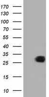 HEK293T cells were transfected with the pCMV6-ENTRY control (Left lane) or pCMV6-ENTRY MIOX (Right lane) cDNA for 48 hrs and lysed. Equivalent amounts of cell lysates (5 ug per lane) were separated by SDS-PAGE and immunoblotted with anti-MIOX.