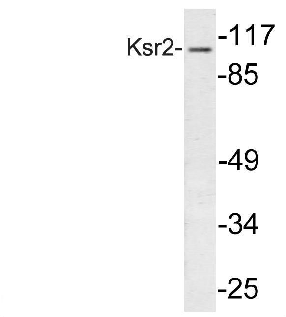 Western blot analysis of Ksr2 (I694)antibody in extracts from 293 cells.