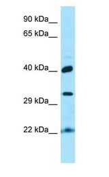 KTI12 antibody Western Blot of Fetal kidney.