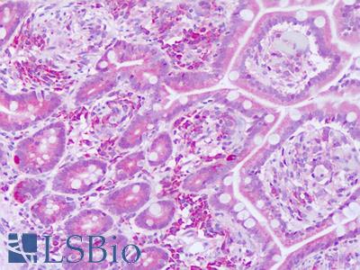 Anti-KTI12 antibody IHC of human testis. Immunohistochemistry of formalin-fixed, paraffin-embedded tissue after heat-induced antigen retrieval. Antibody LS-B8281 dilution 5-10 ug/ml.