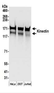 Detection of Human Kinectin by Western Blot. Samples: Whole cell lysate (50 ug) prepared using NETN buffer from HeLa, 293T, and Jurkat cells. Antibodies: Affinity purified rabbit anti-Kinectin antibody used for WB at 0.1 ug/ml. Detection: Chemiluminescence with an exposure time of 3 seconds.