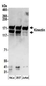 Detection of Human Kinectin by Western Blot. Samples: Whole cell lysate (50 ug) prepared using NETN buffer from HeLa, 293T, and Jurkat cells. Antibodies: Affinity purified rabbit anti-Kinectin antibody used for WB at 0.1 ug/ml. Detection: Chemiluminescence with an exposure time of 30 seconds.