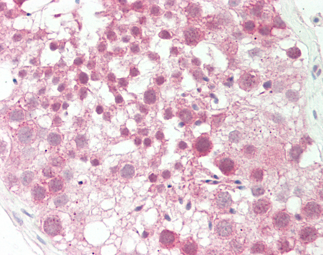 Human Testis: Formalin-Fixed, Paraffin-Embedded (FFPE)