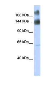 KTN1 antibody LS-C102154 Western blot of Fetal Brain lysate.