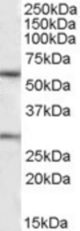 KCNQ1 antibody (1 ug/ml) staining of Human Heart lysate (35 ug protein/ml in RIPA buffer). Primary incubation was 1 hour. Detected by chemiluminescence.