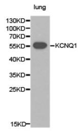 Western blot of extracts of lung cell lines, using KCNQ1 antibody.