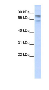 KCNQ1 antibody LS-B4575 Western blot of Fetal Liver lysate.
