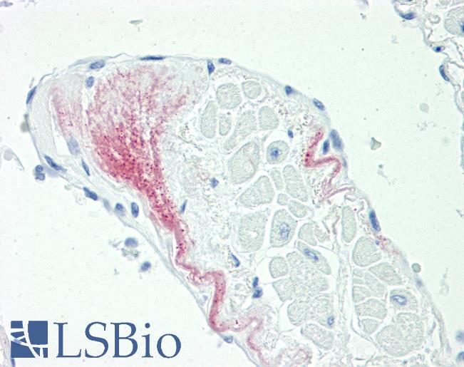 Anti-KVLQT1 / KCNQ1 antibody IHC staining of human heart. Immunohistochemistry of formalin-fixed, paraffin-embedded tissue after heat-induced antigen retrieval. Antibody LS-B9899 dilution 1:50.