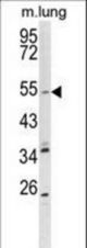 Western blot of KCNQ1 Antibody in mouse lung tissue lysates (35 ug/lane). KCNQ1 (arrow) was detected using the purified antibody.