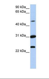 MCF7 cell lysate. Antibody concentration: 1.0 ug/ml. Gel concentration: 12%.
