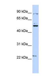 XK antibody LS-C109829 Western blot of HeLa lysate.