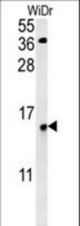 C19orf50 Antibody western blot of WiDr cell line lysates (35 ug/lane). The C19orf50 antibody detected the C19orf50 protein (arrow).