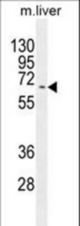 KY Antibody western blot of mouse liver tissue lysates (35 ug/lane). The KY antibody detected the KY protein (arrow).