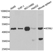 Western blot analysis of extracts of various cell lines, using KYNU antibody.