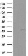 HEK293T cells were transfected with the pCMV6-ENTRY control (Left lane) or pCMV6-ENTRY KYNU (Right lane) cDNA for 48 hrs and lysed. Equivalent amounts of cell lysates (5 ug per lane) were separated by SDS-PAGE and immunoblotted with anti-KYNU.