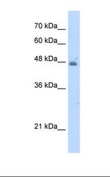 HepG2 cell lysate. Antibody concentration: 5.0 ug/ml. Gel concentration: 12%.