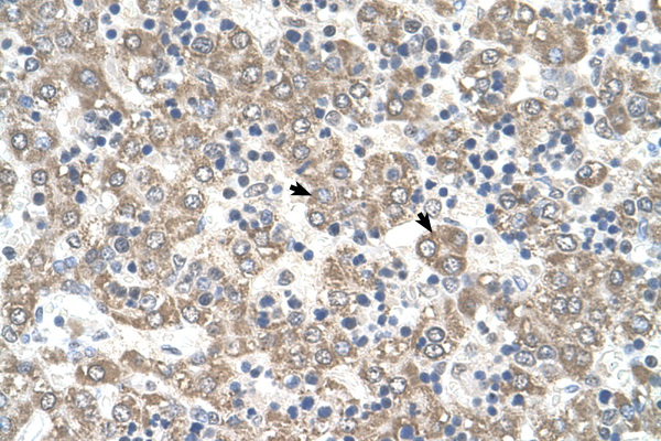 KYNU antibody LS-C80796 IHC of formalin-fixed, paraffin-embedded human Liver. Positive label: Hepatocytes indicated with arrows. Antibody concentration 4-8 ug/ml. Magnification 400X.