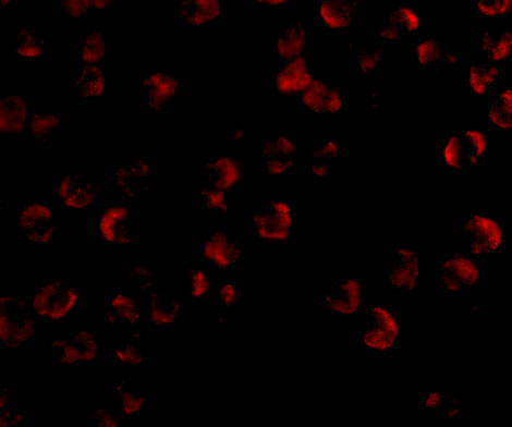 Immunofluorescence of KIF5 in K562 cells with KIF5 antibody at 20 ug/ml.